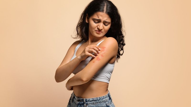Crises de Psoríase: Por Que Elas Surgem e Como Antecipá-las