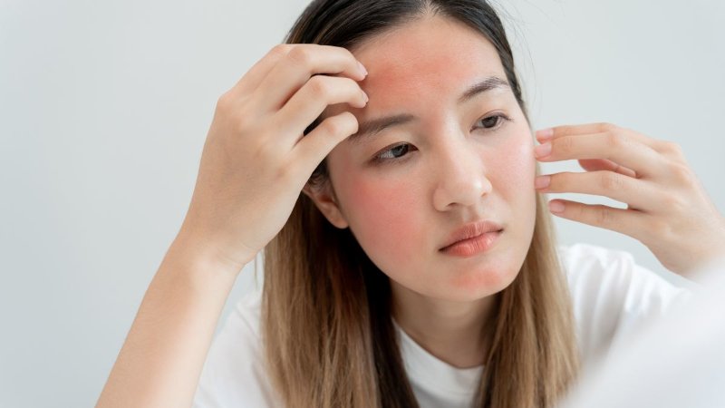 Dermatite Atópica: Por Que a Pele Coça Tanto e Como Controlar as Crises